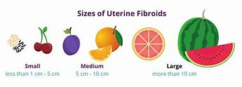 Image result for 4 Cm Fibroid in Uterus