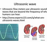 ultrasonic wave 的图像结果