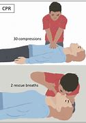 Image result for Mouth to Nose CPR