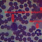 Image result for Immune-Mediated Polyarthritis