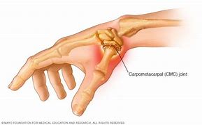 Image result for Thumb Pain Sign