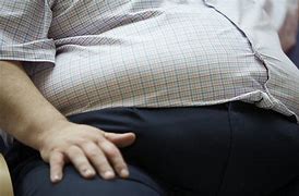 Image result for obese people