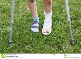 Image result for Broken Leg Cast Clip Art