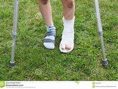 Image result for Butch Patrick On Crutches