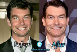 Image result for Jerry O'Connell Before and After