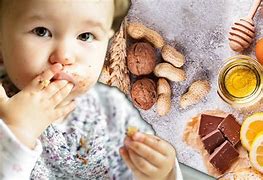 Image result for Apple Allergy Baby