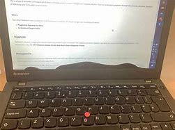 Image result for ThinkPad Dead Pixel