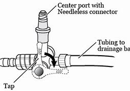 Image result for Accordion Drain Uresil