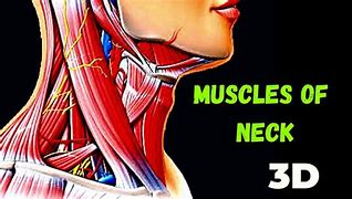 Image result for Strained Neck Muscle
