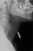 Image result for Phone Taser in X-ray