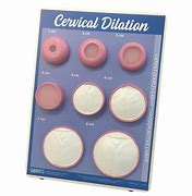 Image result for Graphic Cervical Dilation Chart