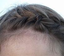 Image result for 1Cm Hair Women