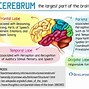 Image result for _Brain Anatomy