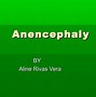 Image result for All Images of Anencephaly
