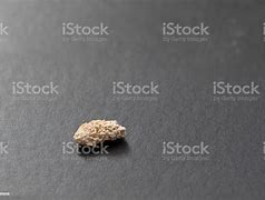Image result for 5 Millimeter Kidney Stone