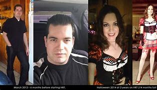 Image result for M2F Transitions 5 Years HRT