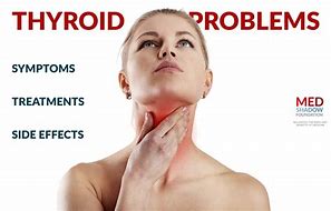 Image result for Thyroid Patient