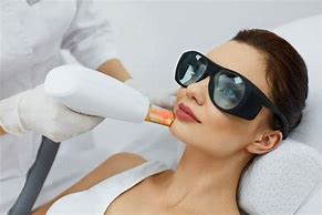 Image result for Laser Skin Treatment