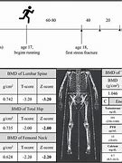 Image result for Normal Bone Density Chart