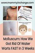 Image result for Swimming with Molluscum