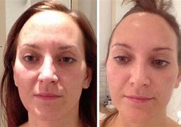 Image result for Therapy Clinic Before and After