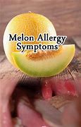 Image result for Watermelon Allergic Reaction
