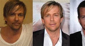 Image result for Sean Patrick Flanery Plastic Surgery