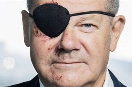 Image result for Olaf Scholz Eye Patch Meme