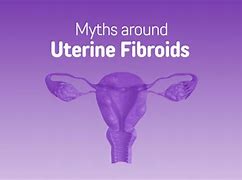 Image result for 14 Cm Fibroid