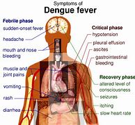 Image result for dengue