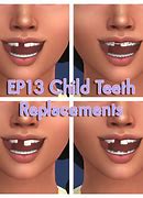 Image result for Sims 4 Teeth