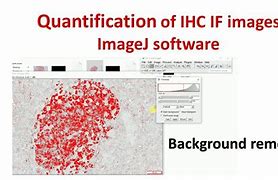 Image result for IHC Quantification