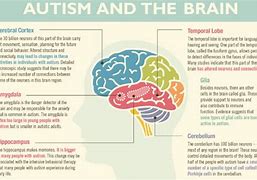 Image result for Autism Spectrum Disorder Brain
