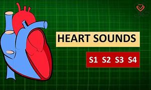 Image result for Heart Sounds Diagram
