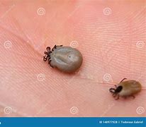 Image result for Small Ticks On Humans
