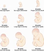 Image result for Growth Chart for Gestational Age