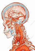 Image result for Neck Angio