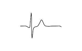 Image result for EKG with Heart Picture Grey Background