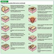 Image result for 4 Cm Lesion