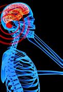 Image result for Cell Phone Radiation Effects