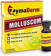 Image result for ZymaDerm Molluscum