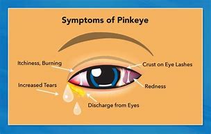 Image result for Pink Eye Logo