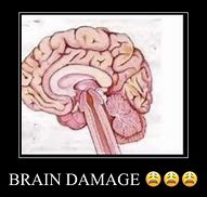 Image result for Malo Brain Damage Meme