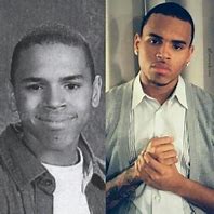 Image result for Chris Brown Plastic Surgery