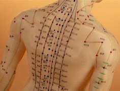 Image result for Acupuncture Full Body