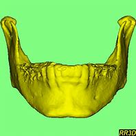 Image result for Human Jawbone