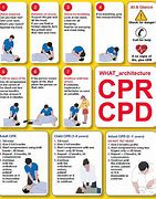 Image result for 1st Step of CPR Drawing