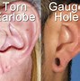 Image result for What Do 20 mm Hops Look Like On Ear