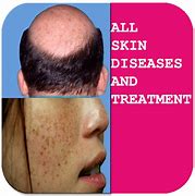 Image result for Human Skin Diseases