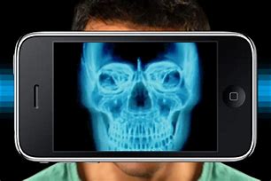 Image result for X-ray for iPhone